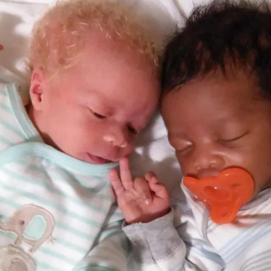 Mom Of Black And White Twins Say: People Don’t Believe They Are Twins 3