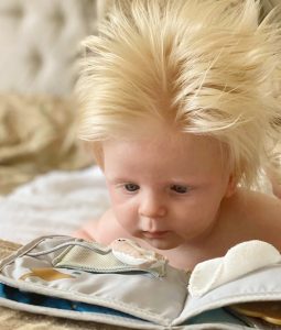 Baby Born With Full Head Of Blond Hair Makes Curious Everyone..Amazing 5