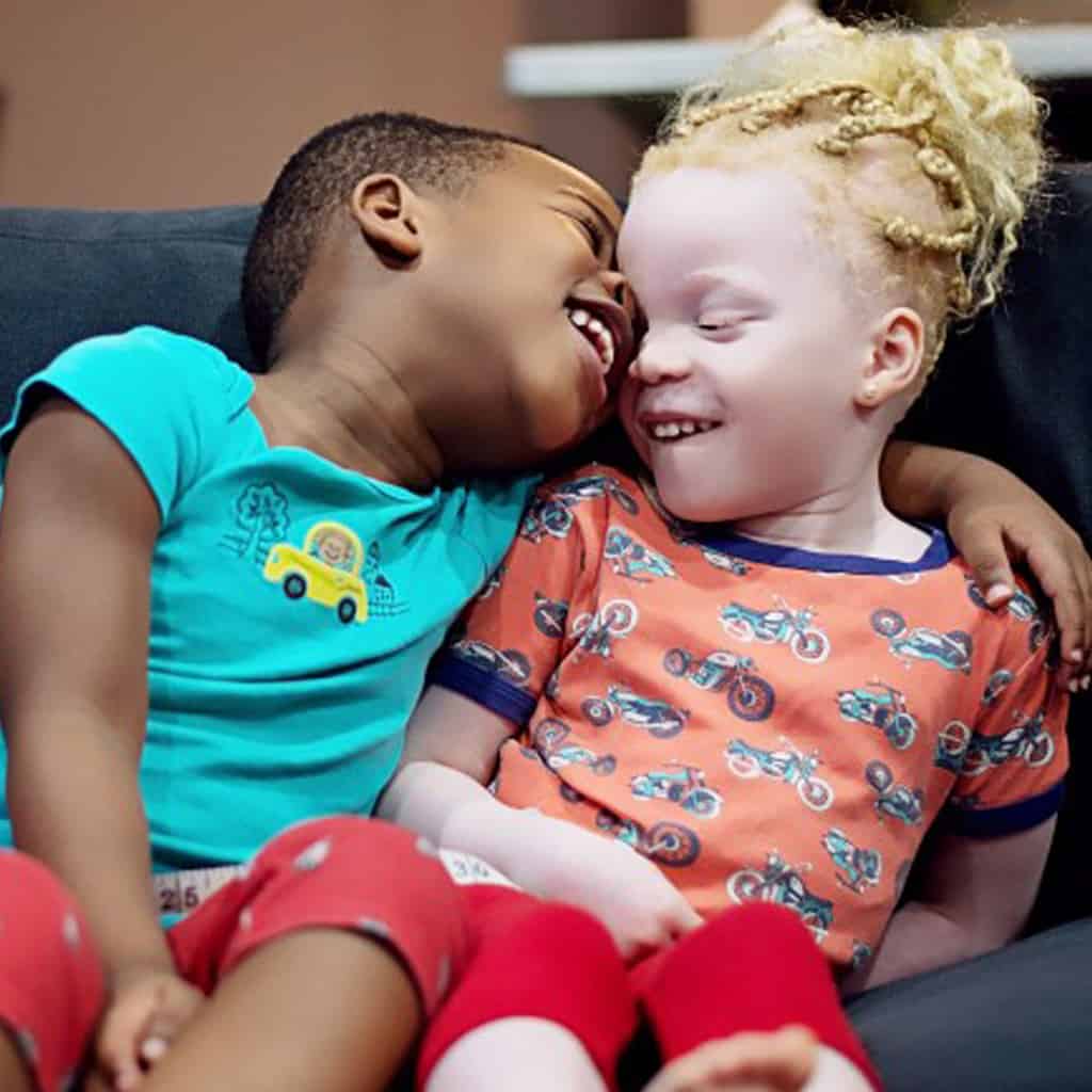 Mom Of Black And White Twins Say: People Don’t Believe They Are Twins 7