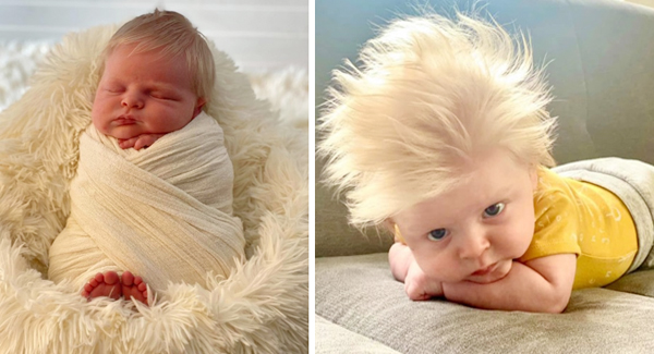 Baby Born With Full Head Of Blond Hair Makes Curious Everyone..Amazing 1