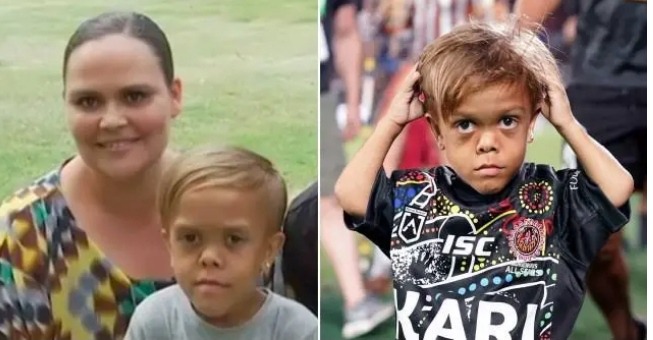 Remember The 11-year Old Boy That Once Tried To Kill Himself Due To His Height : See His New Looks 8