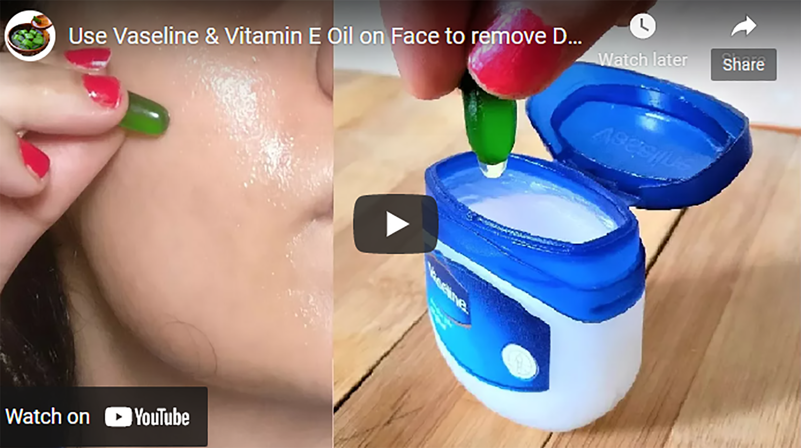 Watch: How To Use Vaseline & Vitamin E Oil On Your Face To Remove Dark Spots 1