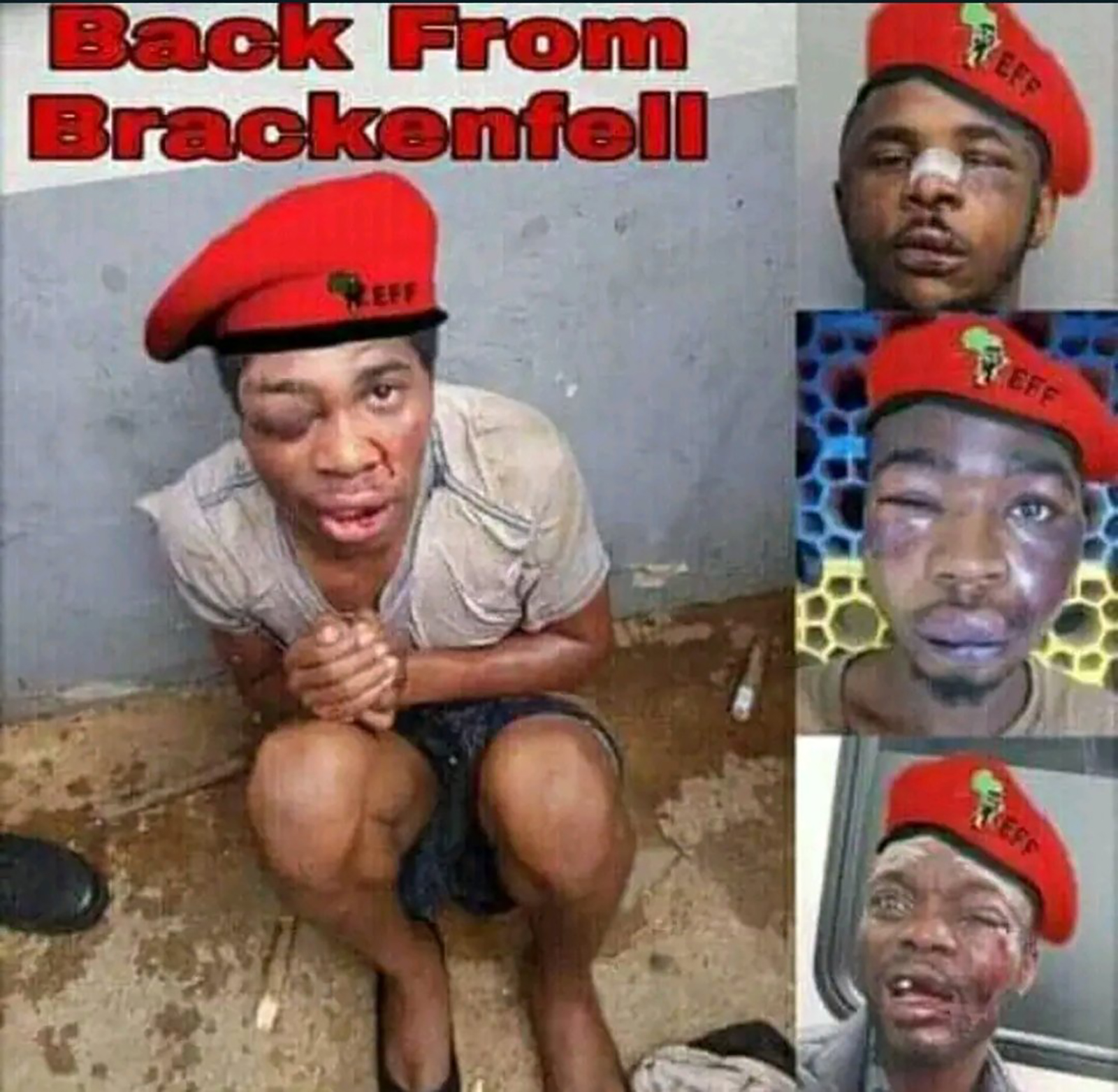 The Picture of Beaten EFF Members Go Viral SEE What Members Says 1