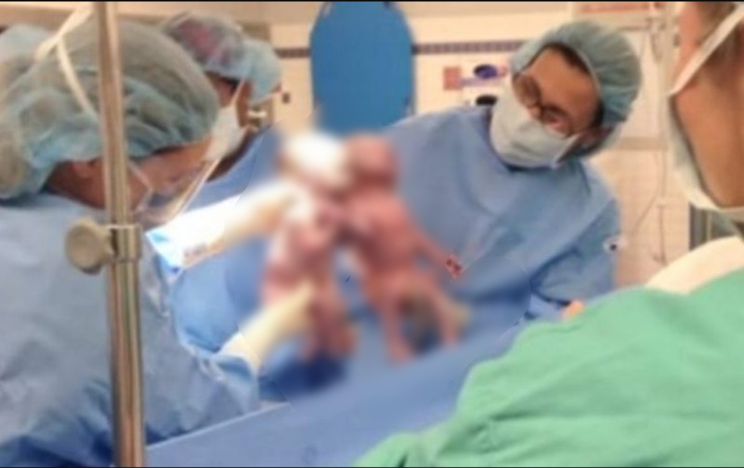 See Mother hears doctors gasp moments after delivering her babies, looked down, and quickly realized why 1