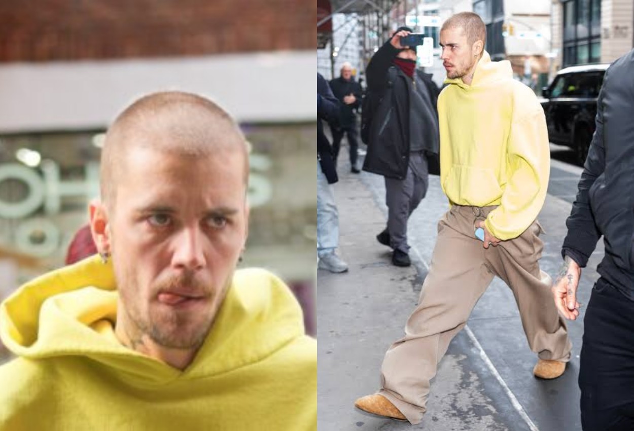 Justin Bieber’s Struggles: Marriage Woes, Diddy Scandal, and Mental Health Concerns